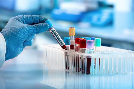 Laboratory Equipment - Professional lab setting with test tubes, samples, and scientific equipment